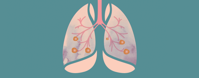 Hibridinės konferencijos „Plaučių vėžio imuno ir taikinių terapija 2023“ programa