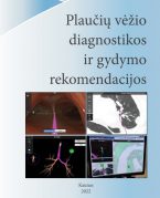 Plaučių vėžio diagnostikos ir gydymo rekomendacijos 2022 m.